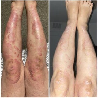 powercurc30 before and after