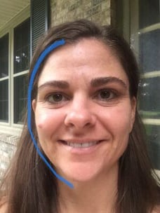 before and after pictures