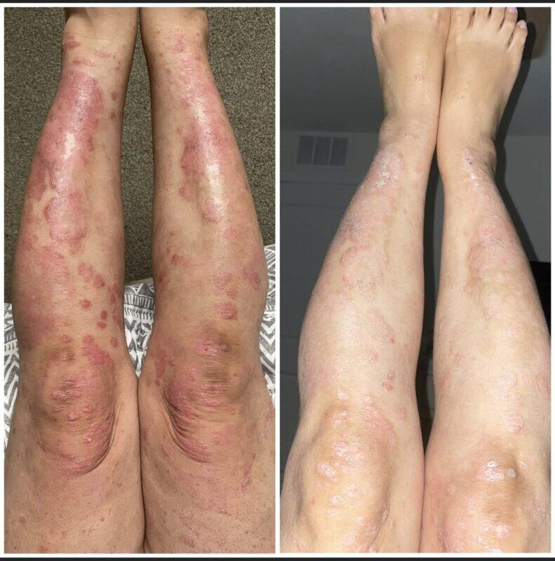 7-Step Approach to Healing Yourself cover